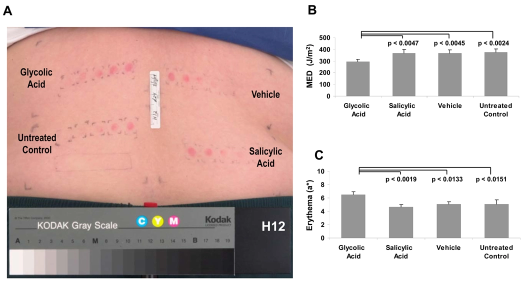 甘醇酸與水楊酸對紫外線造成的皮膚紅斑反應比較圖