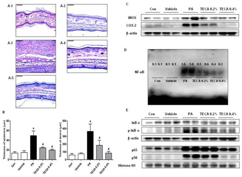 TECA 外用後皮膚組織切片與 NF-κB 活性分析